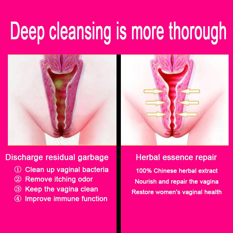 Feminine Care Supplier - Hot Sale Natural Herbal Personal Logo