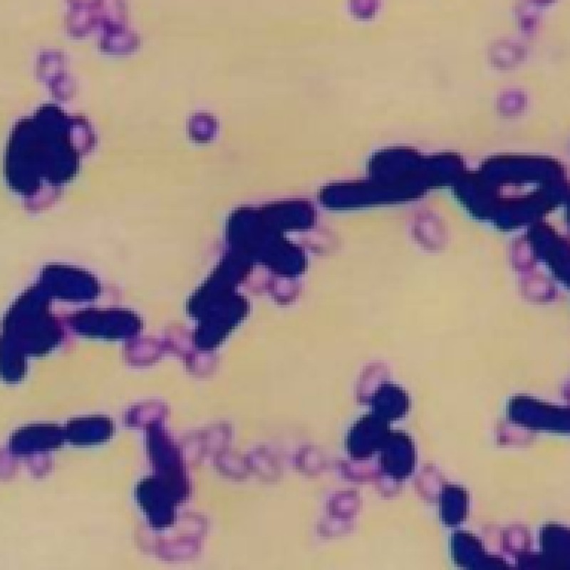 Manufacturer Direct Supply Brown Powder Bacillus Licheniformis Probiotics for Aquaculture Animals Enhances Resistance