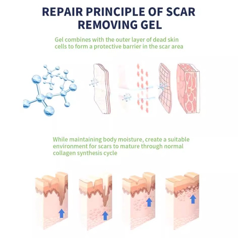 Scar Gel Manufacturer - Custom Advanced 100% Silicone Scar Removal Gel