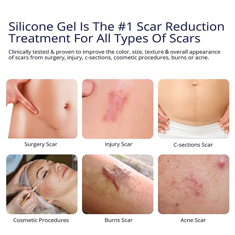 Scar Gel Manufacturer - Custom Advanced 100% Silicone Scar Removal Gel