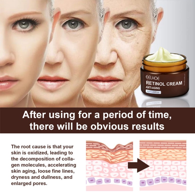 Retinol Cream Manufacturer - Anti Aging Remove Wrinkles Fast Whitening Cream