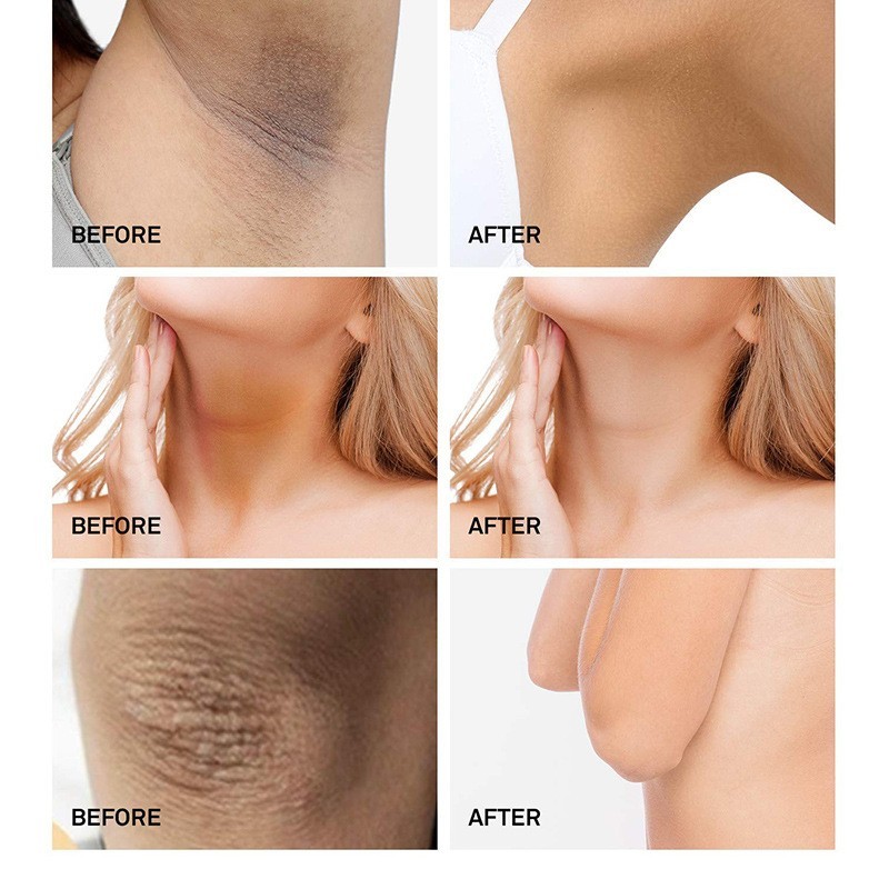 Cleansing Soap Factory - Best Selling Essential Oil Soap Anti Acne Glutathione