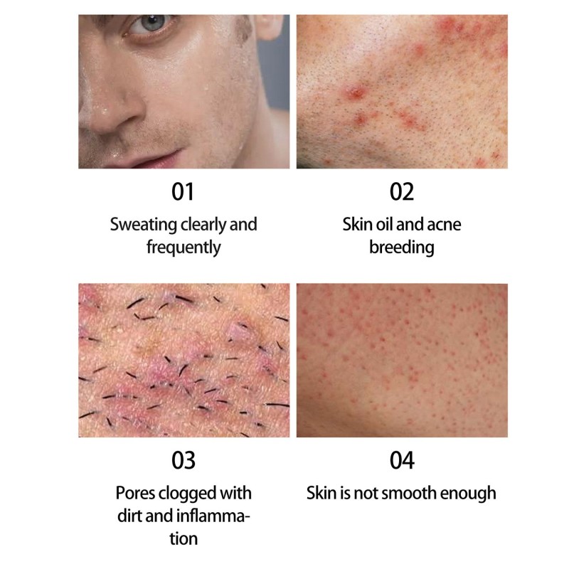 Nose Strips Supplier - High Quality Lanbena Blackhead Removal Deep Cleansing