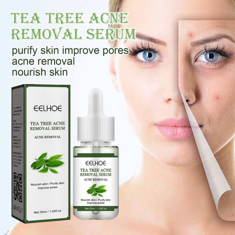 Facial Serum Supplier - 30 ml Herbal Plant Anti Wrinkle Acne Remover Serum