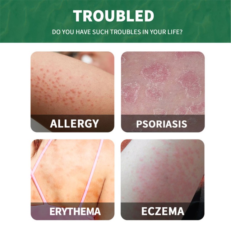 Calming Cream Factory - South Moon Ultra Gentle Reduce Inflammation Cream