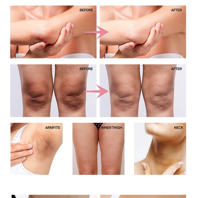 Cleansing Soap Factory - Best Selling Essential Oil Soap Anti Acne Glutathione