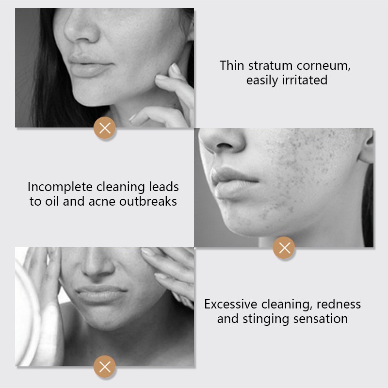 Facial Cleanser Supplier - Flower Cleanser Mousse Exfoliating Removing Blackheads