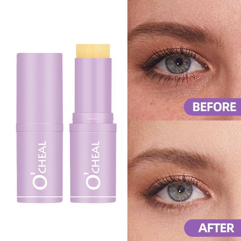 Eye Cream Manufacturer - Moisturizing Hydrating Reduces Fine Lines Improves