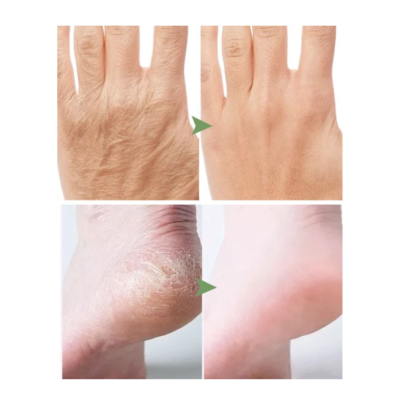 Foot Mask Factory - Korea Spa Pedicure Paraffin Wax Moisture Peeling Remove