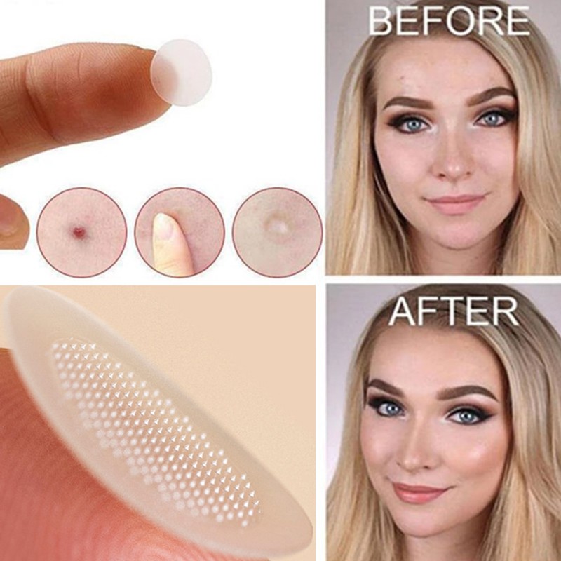 Acne Stickers Manufacturer - Wholesale Various Shapes Microneedle Blemish Remove