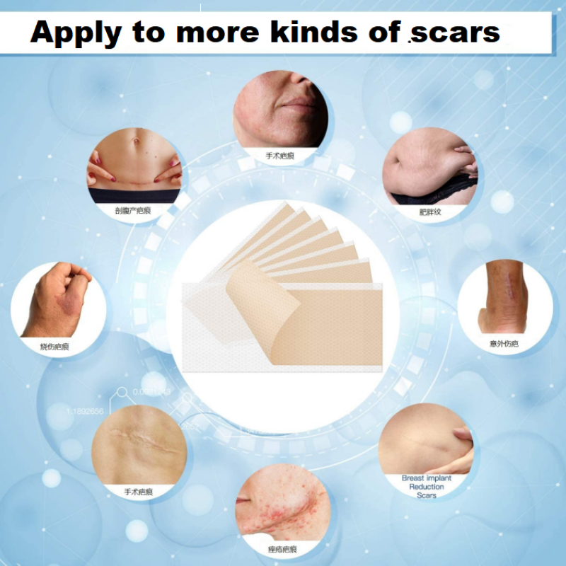 Silicone Patches Manufacturer - Private Label Silicone Belly Eye Patches Reusable