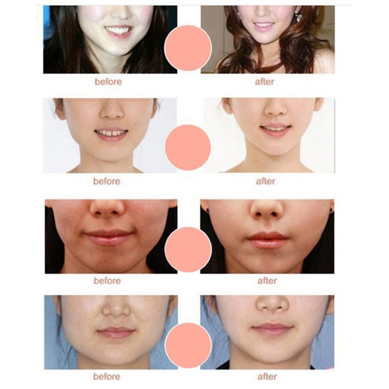 Face Slimming Patch Factory - Korea Double Line Band Chin Lifting V Shape