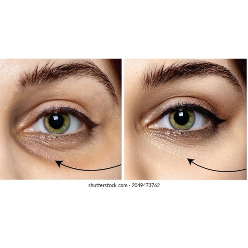 Silicone Eye Pads Factory - Reusable Cooling Under Eye Moisturizer Skin Care