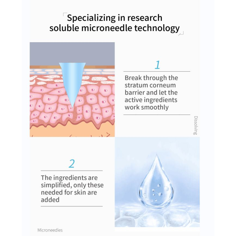 Acne Stickers Supplier - Hydrocolloid Pimple Healing Micro Needle Salicylic