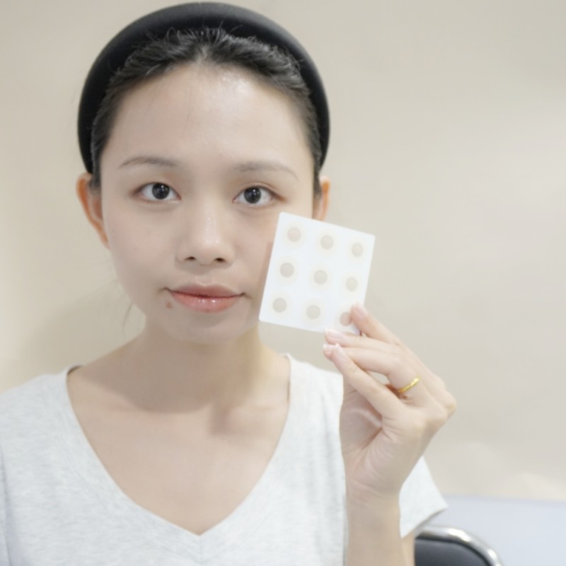 Acne Patch Manufacturer - Fast Healing Hyaluronic Acid Pimple Microneedle