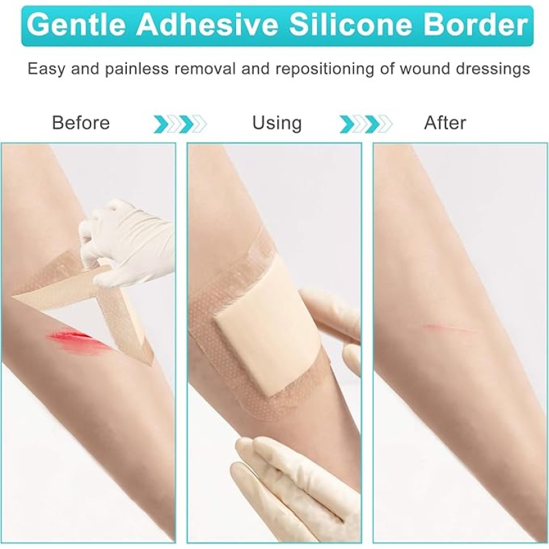 Non-woven Fabric Tape Manufacturer - First Aid Wound Plaster