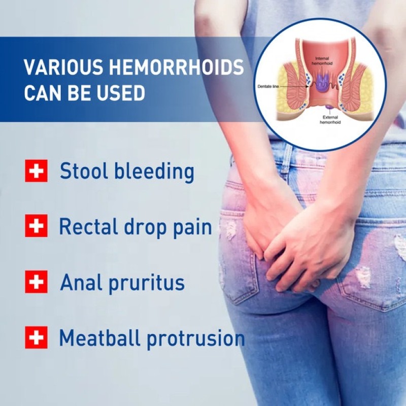 Hemorrhoid Cream Supplier - Anus Repair Cream Mixed Formula