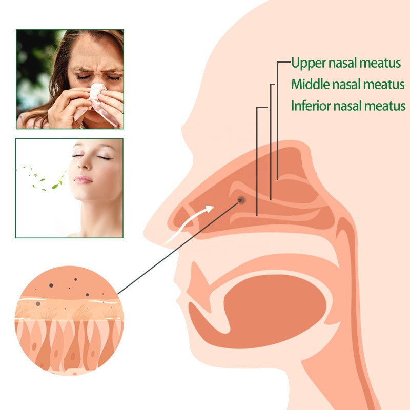 Herbal Spray Manufacturer - Lung Care Nose Relief Custom