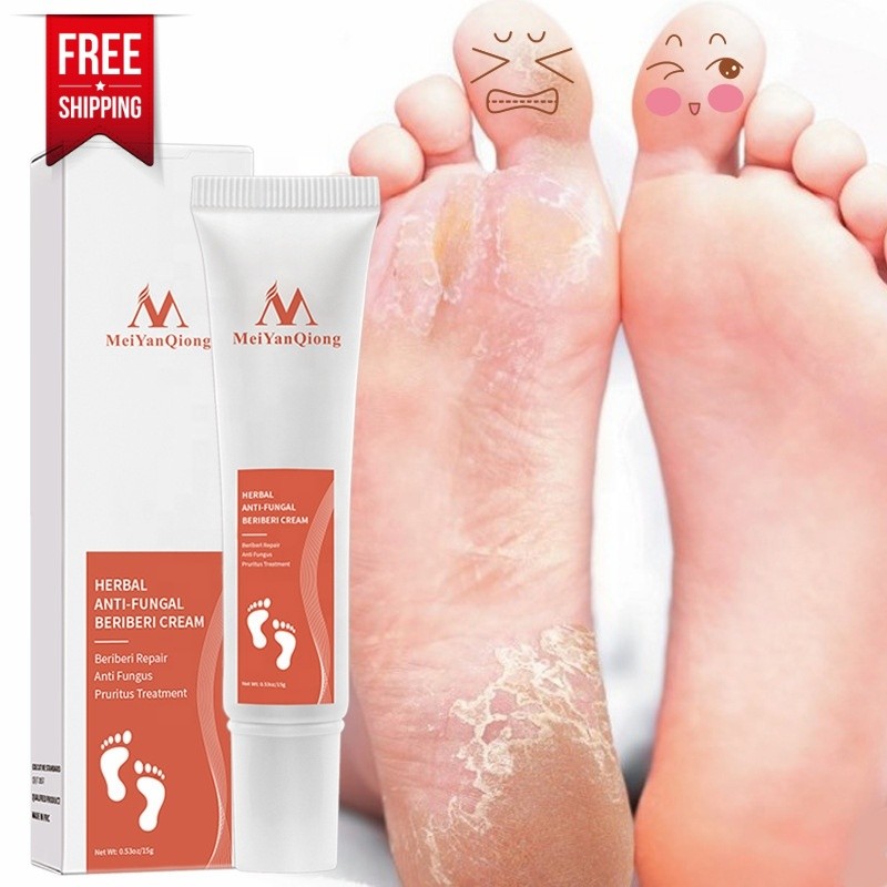 Foot Cream Supplier - Anti Fungal Beriberi Treatment Gel