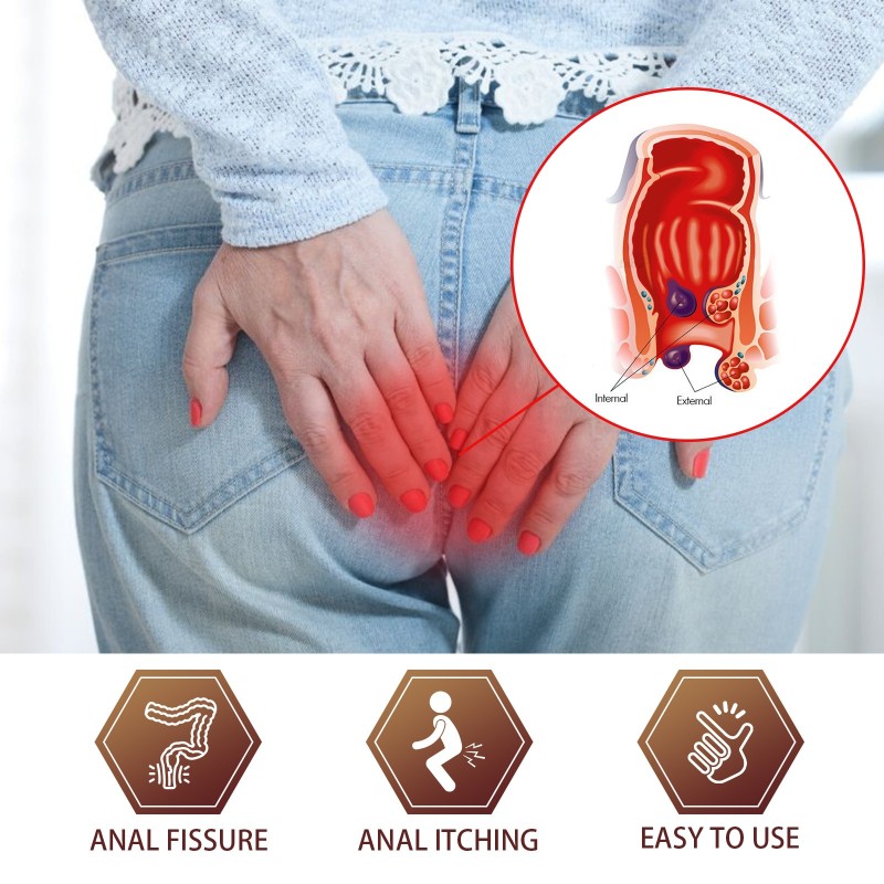 Hemorrhoid Relieving Cream Manufacturer - Anal Swelling Itching