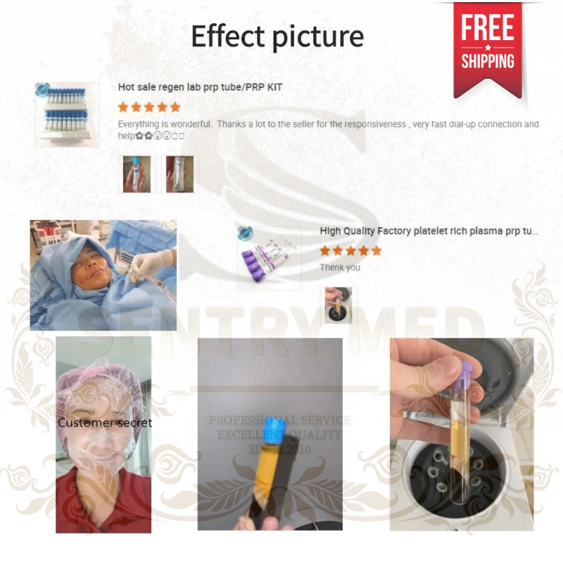 PRP Tube Supplier - 12ml Sodium Citrate Gel Free Shipping