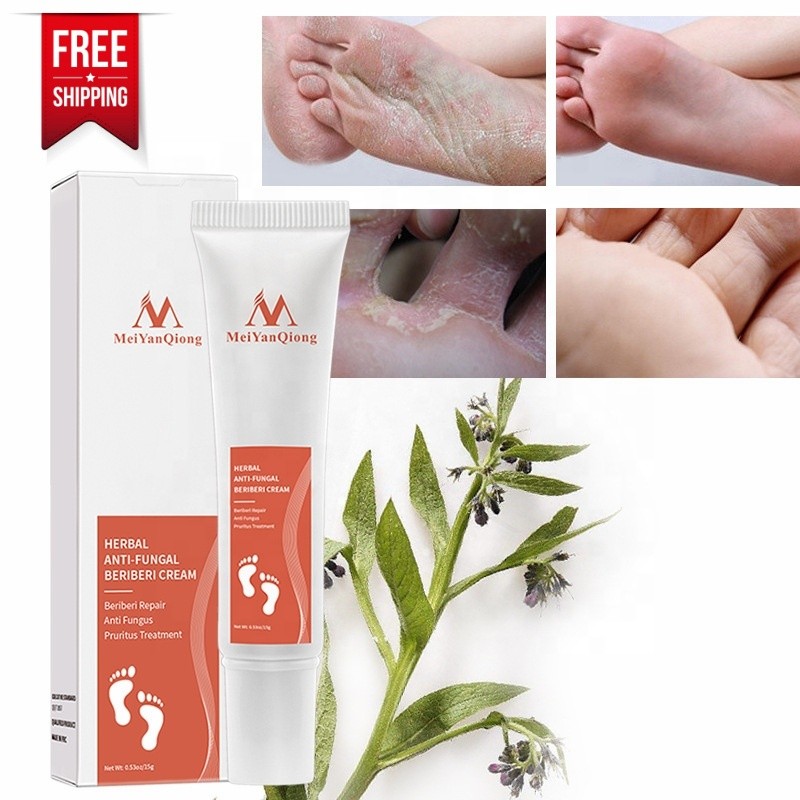 Foot Cream Supplier - Anti Fungal Beriberi Treatment Gel