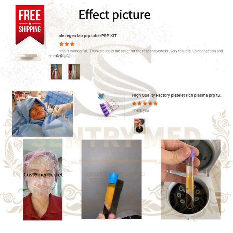 PRP Tube Manufacturer - ACD-A Without Gel Low Price OEM