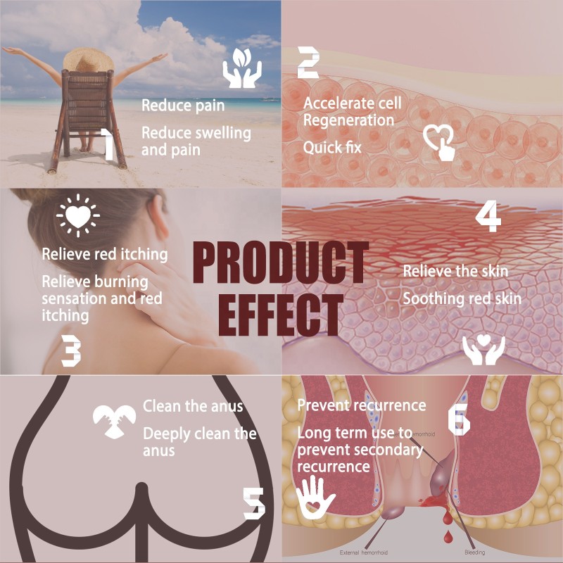 Hemorrhoid Relieving Cream Manufacturer - Anal Swelling Itching
