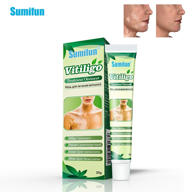 White Spot Cream Factory - Herbal Skin Care Vitiligo