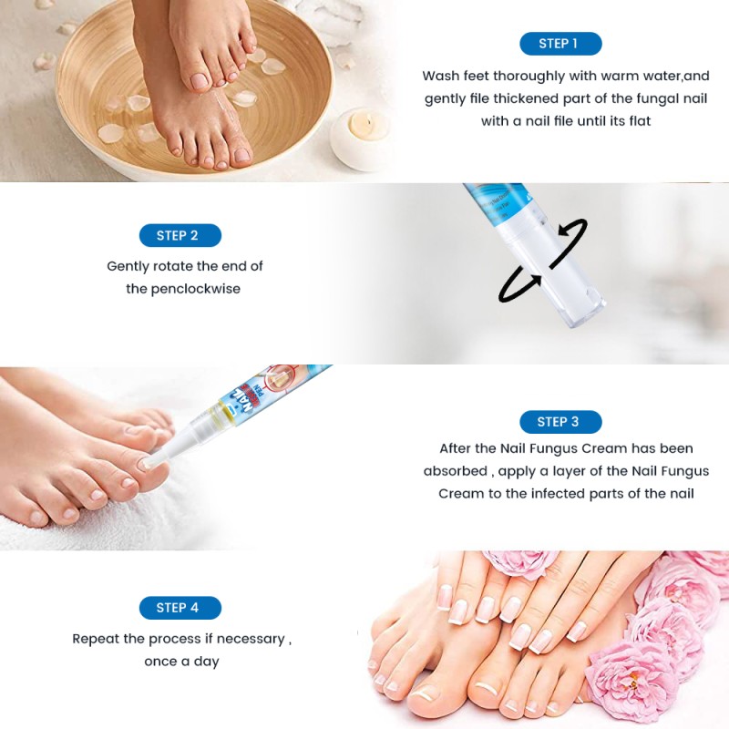 Nail Fungus Liquid Supplier - Painless Anti Bacteria Treatment