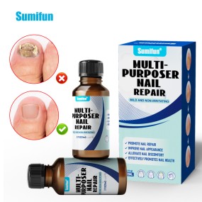 Nail Repair Liquid Supplier - Herbal Fungus Treatment