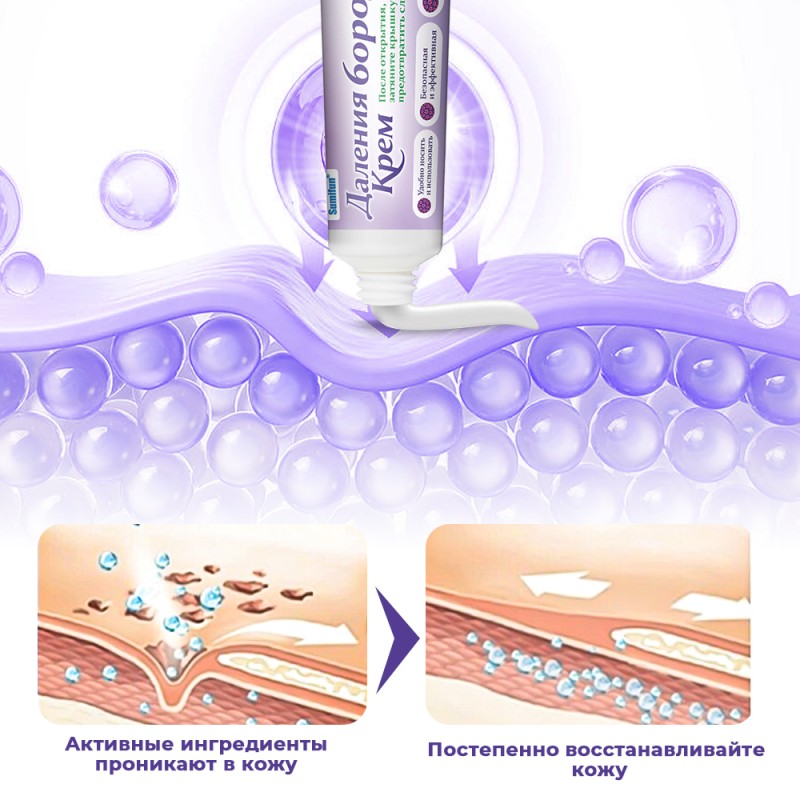 Skin Tag Removal Kit Supplier - Safe Tools Ointment Private Label