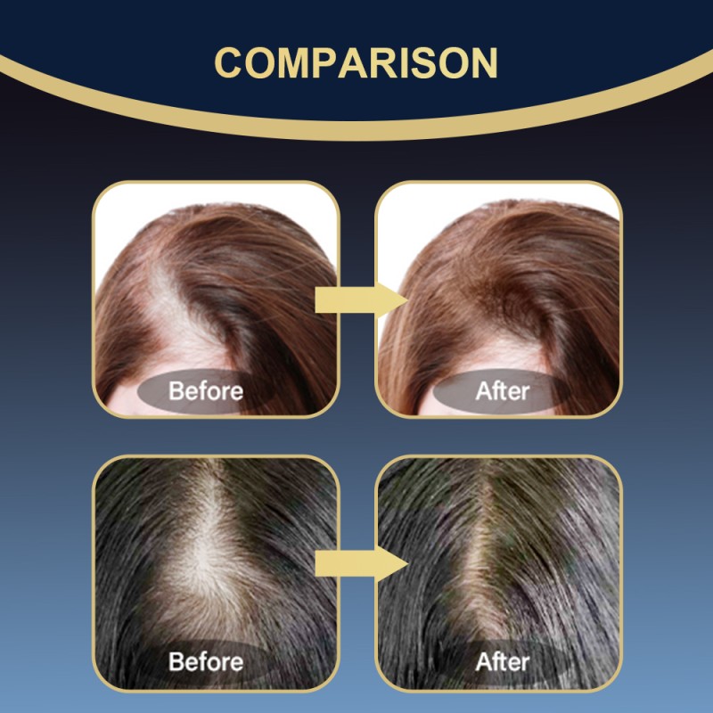 Scalp Nutrient Solution Manufacturer - Herbal Dry Damaged Hair