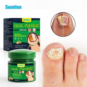 Nail Fungus Cream Supplier - Foot Fungal Treatment