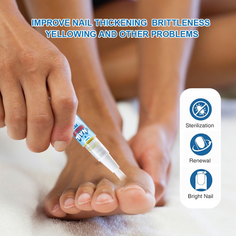 Nail Fungus Liquid Supplier - Painless Anti Bacteria Treatment