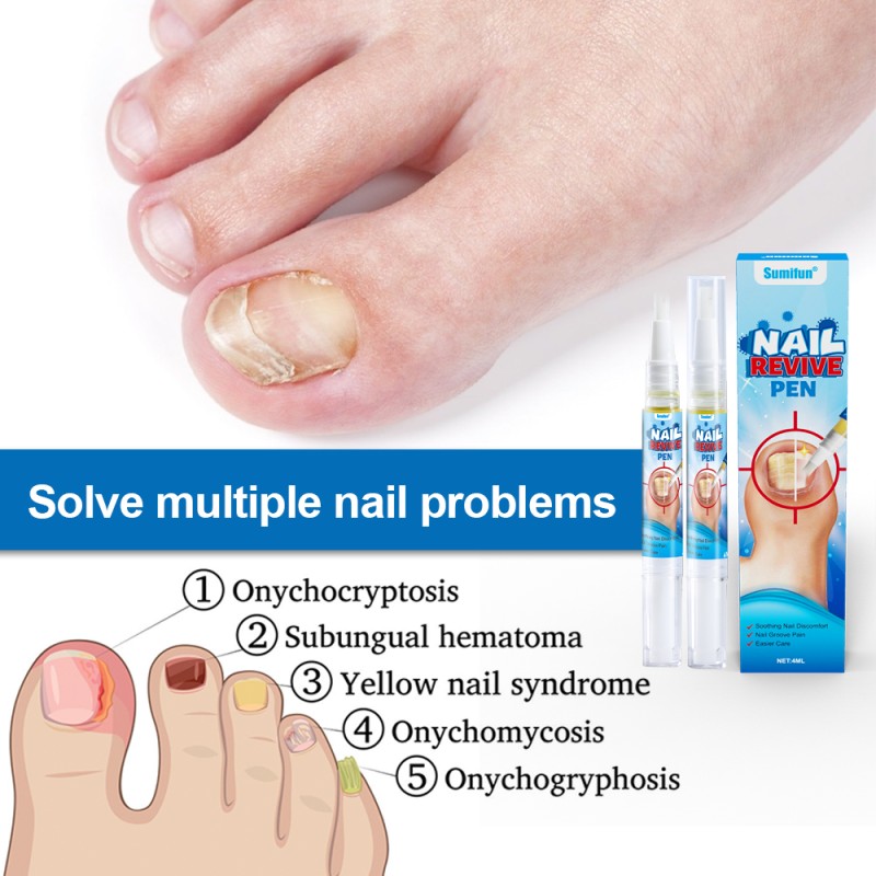 Nail Fungus Liquid Supplier - Painless Anti Bacteria Treatment