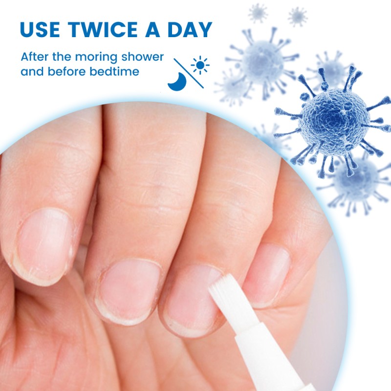 Nail Fungus Liquid Supplier - Painless Anti Bacteria Treatment