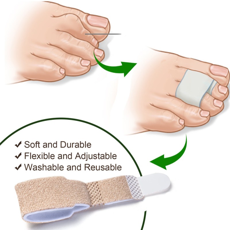 Toe Straightener Supplier - Adjustable Crooked Toes Corrector