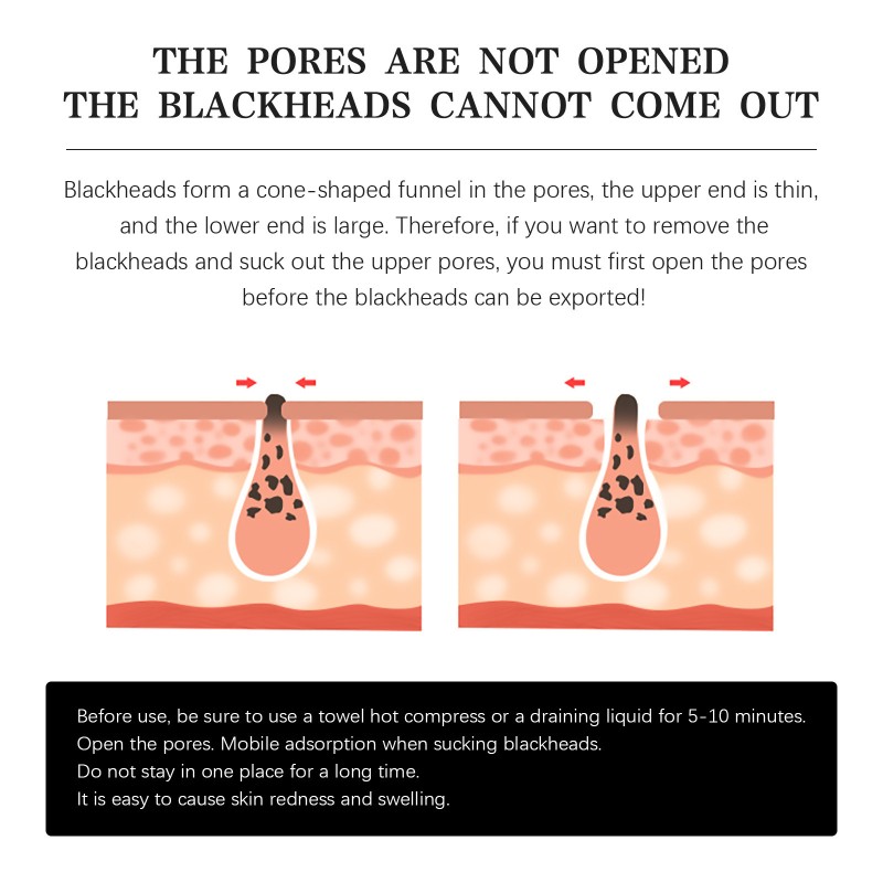 Blackhead Nose Patch Manufacturer - Pore Cleansing Custom Packaging