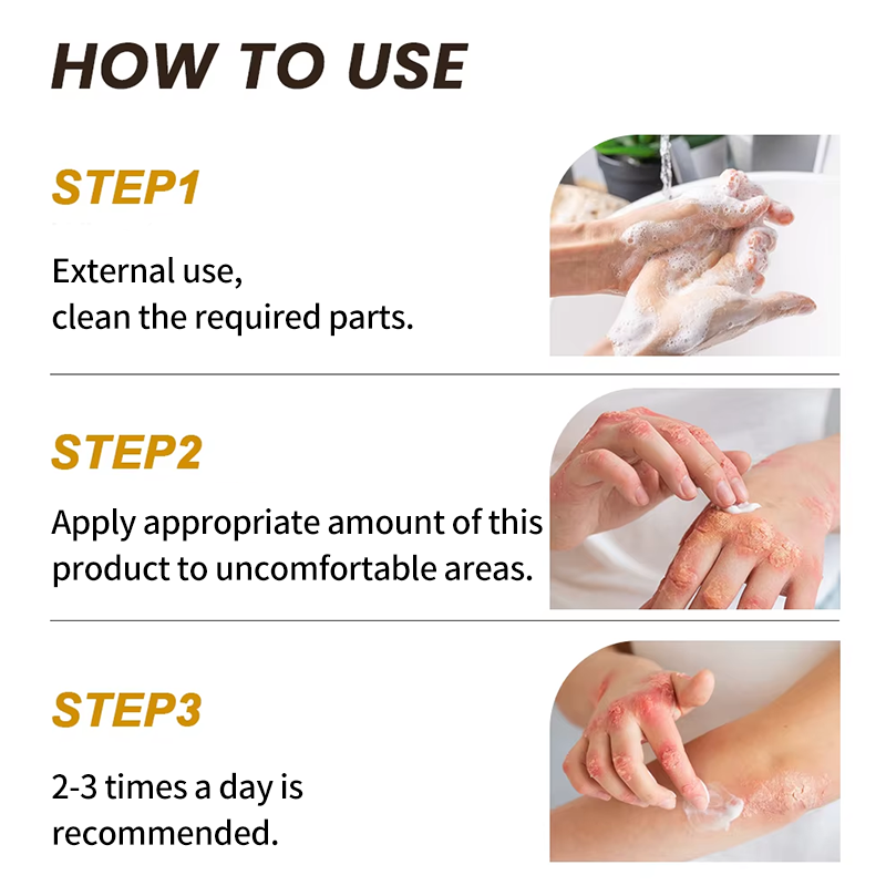 Scar Ointment Factory - Herbal Burn Skin Care