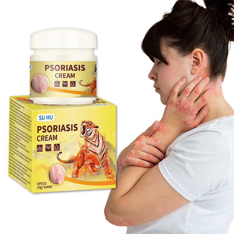 Skin Tinea Cream Supplier - Neck Back Hand Joint Itch