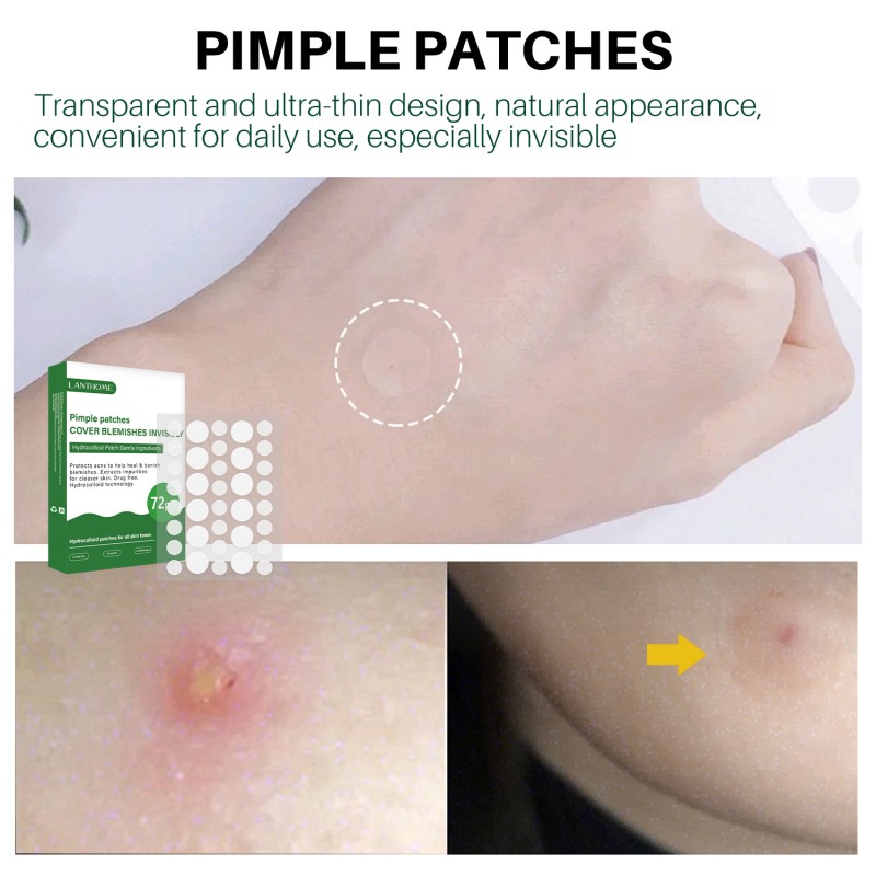 Acne Free Patch Supplier - 72 Pieces Facial Skin Care