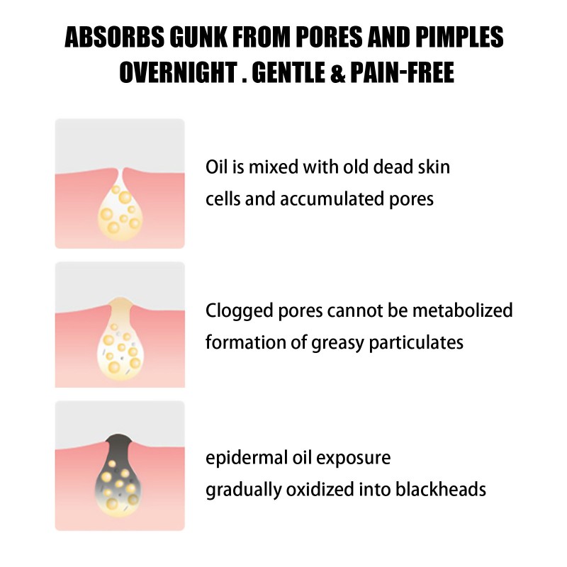 Blackhead Nose Patch Manufacturer - Pore Cleansing Custom Packaging