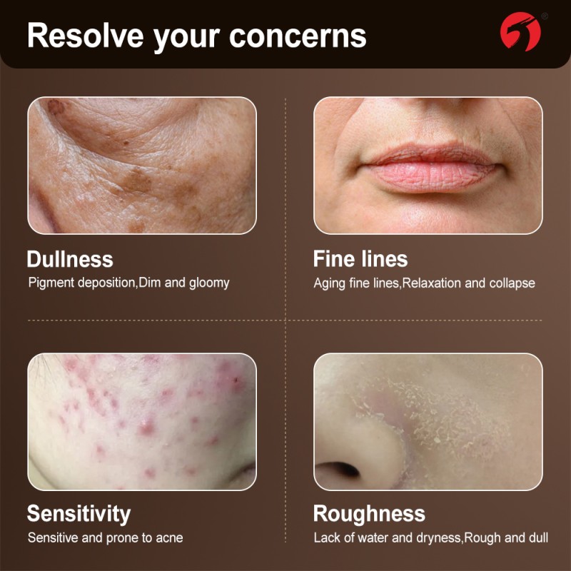 Skin Whitening Capsules Manufacturer - Spot Removal Circulation