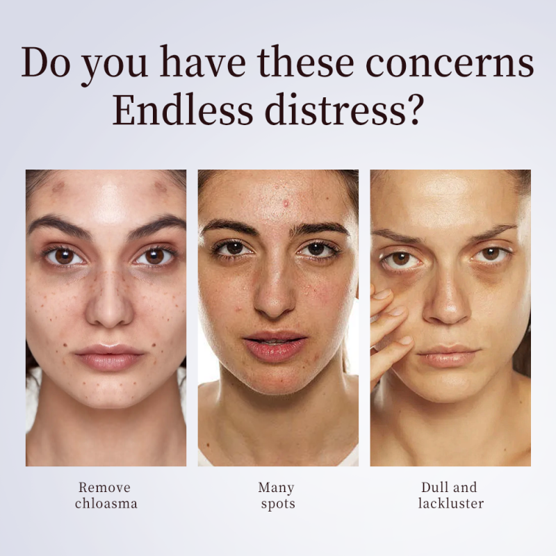 Beauty Oral Liquid Factory - Female Tonic Melasma Regulation