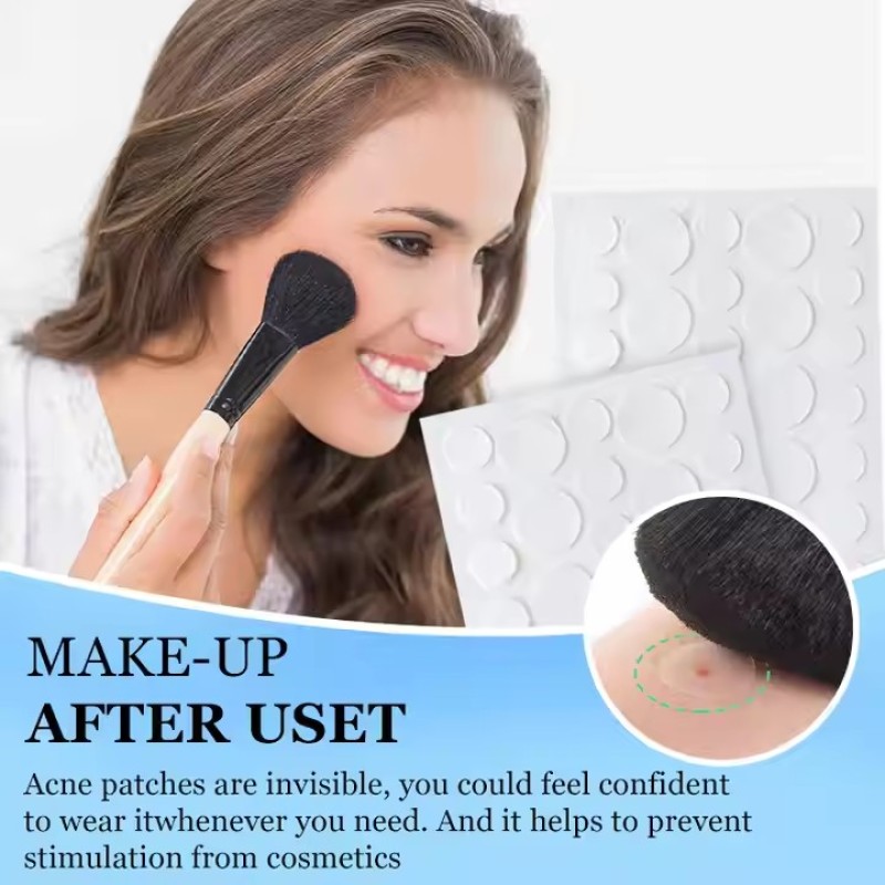 Hydrocolloid Acne Patch Factory - Transparent Pimple Treatment