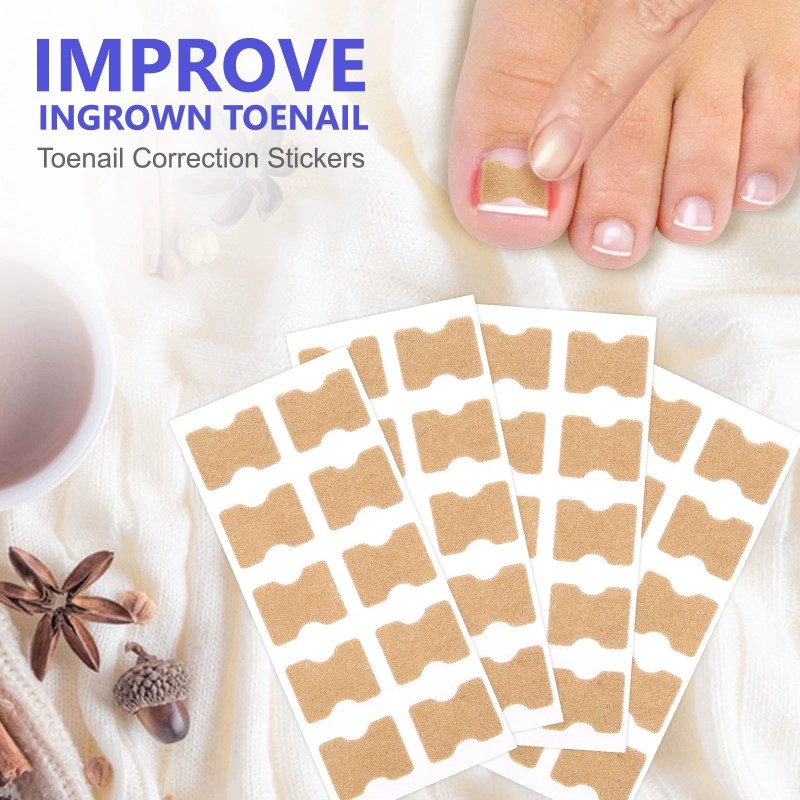 Nail Treatment Patch Factory - Anti Fungal Ingrown Toenail