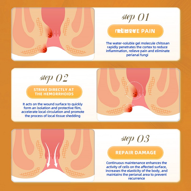 Hemorrhoid Cream Manufacturer - 20g Herbal Anal Fistula