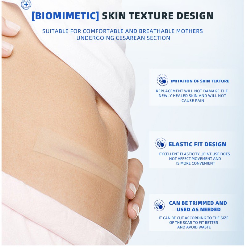 Medical Scar Tape Supplier - Keloid Cesarean Section Care
