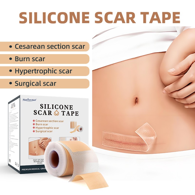 Medical Scar Tape Supplier - Keloid Cesarean Section Care